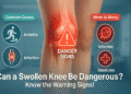 Can a Swollen Knee Be Dangerous