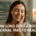 how long does a root canal take to heal